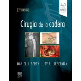 Cirugia de la cadera Berry & Lieberman 2 ed.
