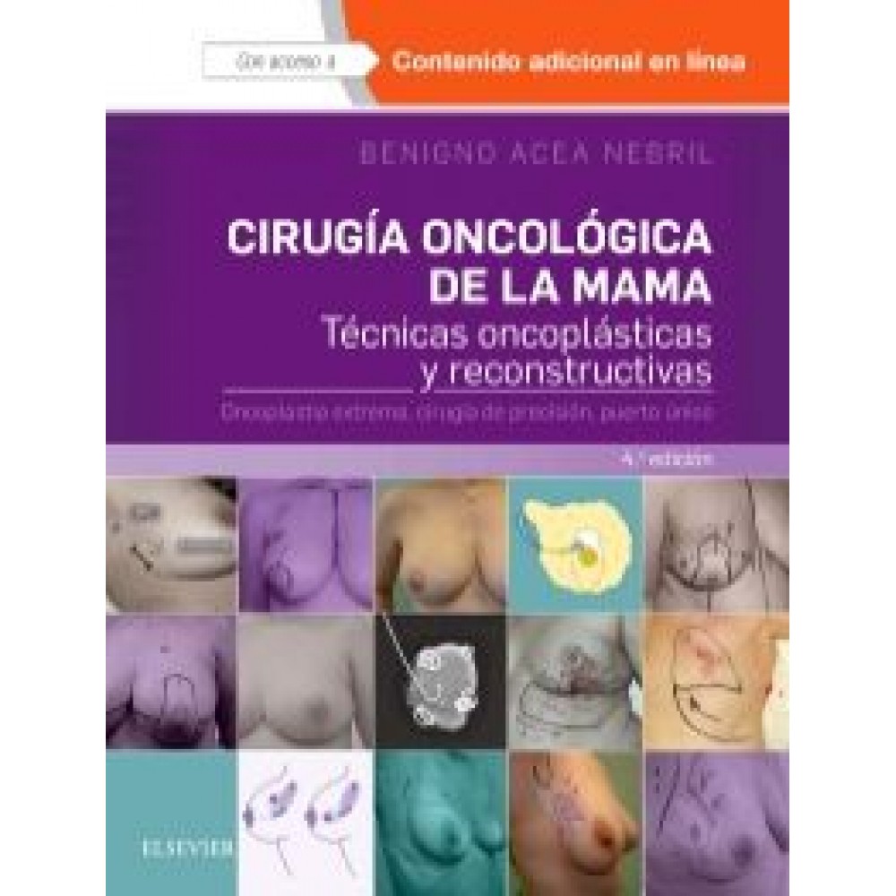 Cirugia oncologica de la mama 4ª ed. - Acea