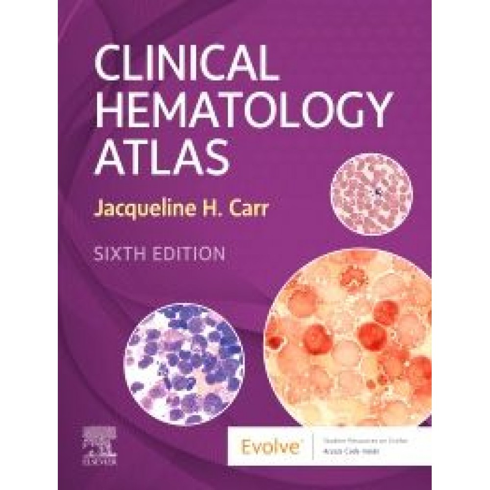Clinical Hematology Atlas, 6th Edition Carr, J.