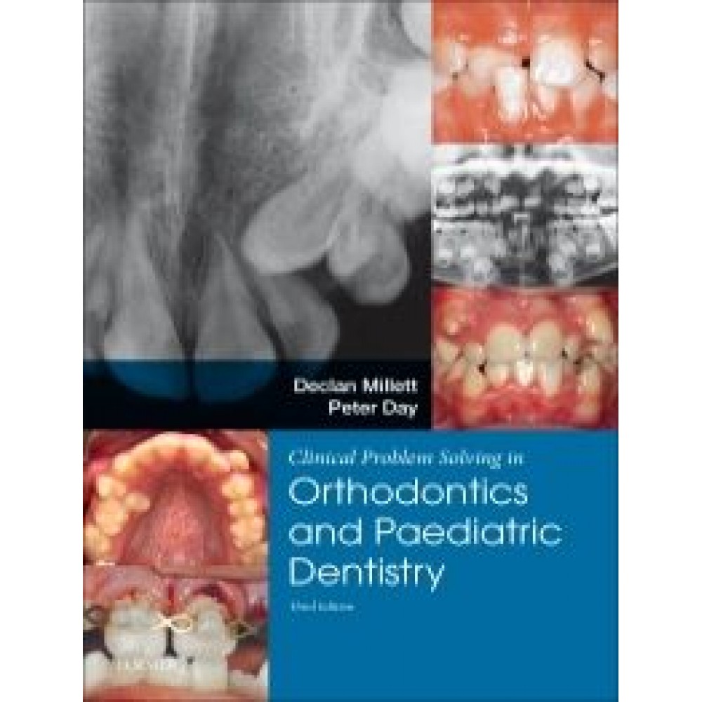 Clinical Problem Solving in Dentistry: Orthodontics and Paediatric Dentistry, 3rd Edition - Millett