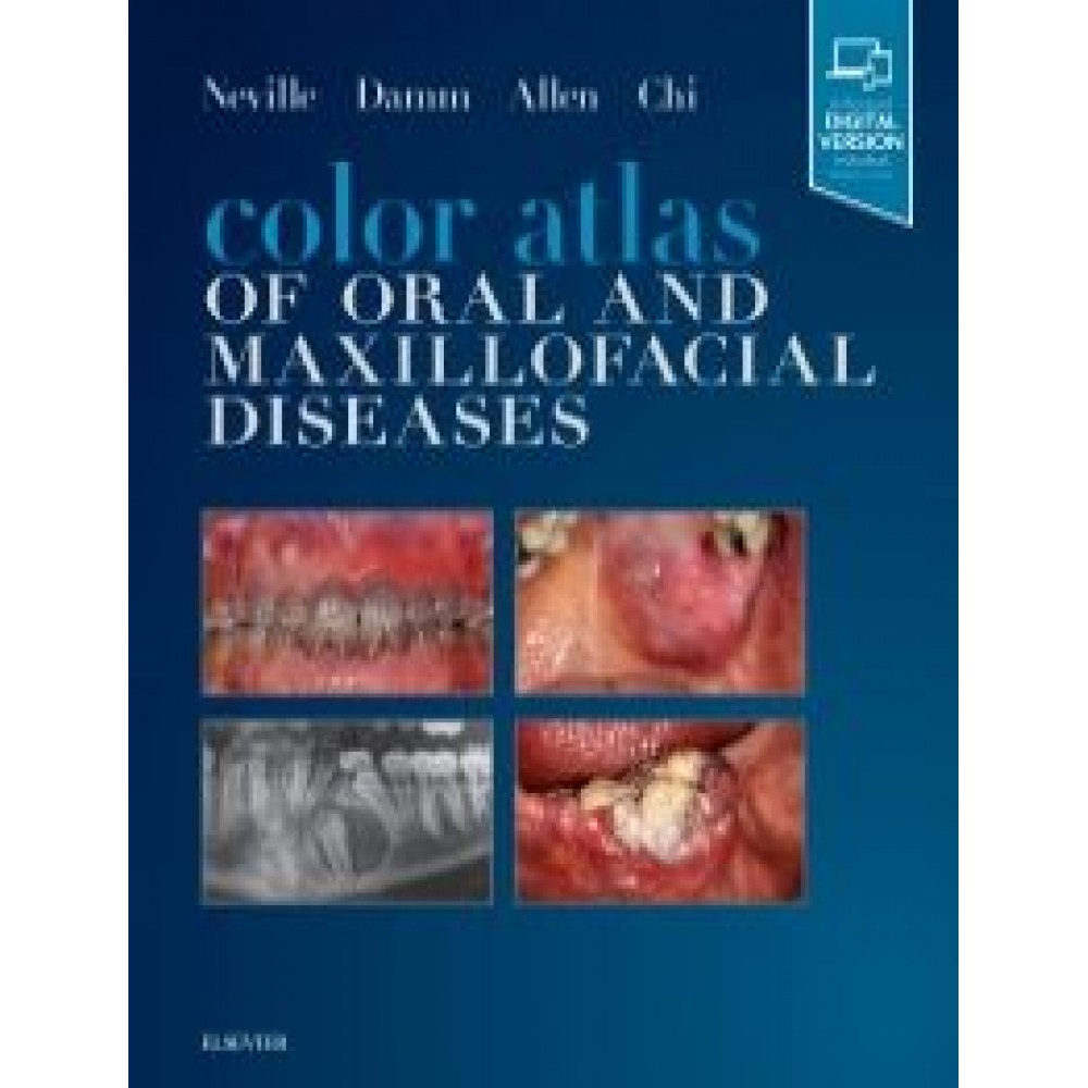 Color Atlas of Oral and Maxillofacial Diseases - Neville