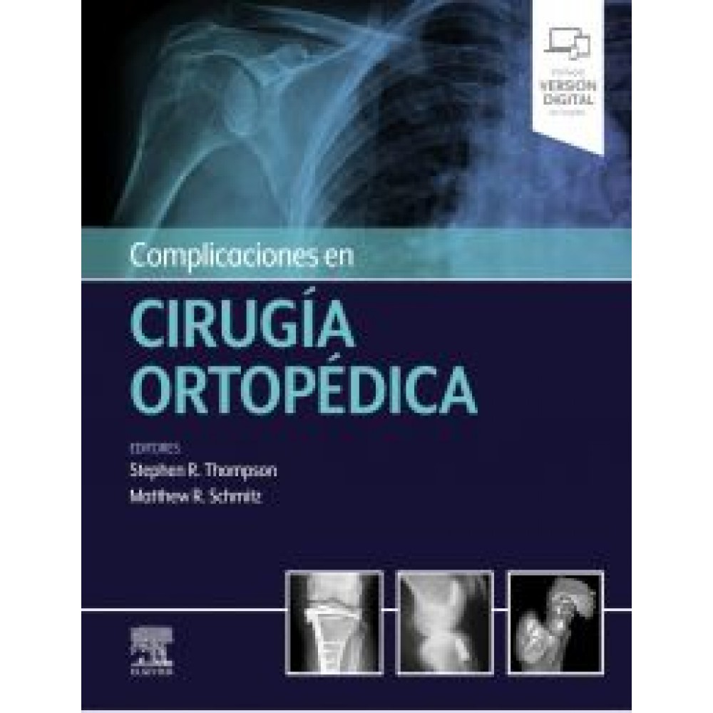 Complicaciones en cirugia ortopedica Stephen R. Thompson