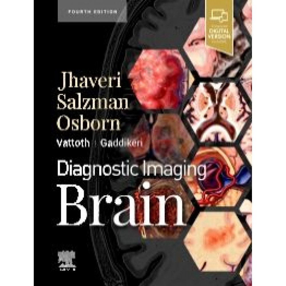 Diagnostic Imaging: Brain, 4th Ed. - Osborn / cols