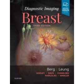 Diagnostic Imaging: Breast, 3rd Edition