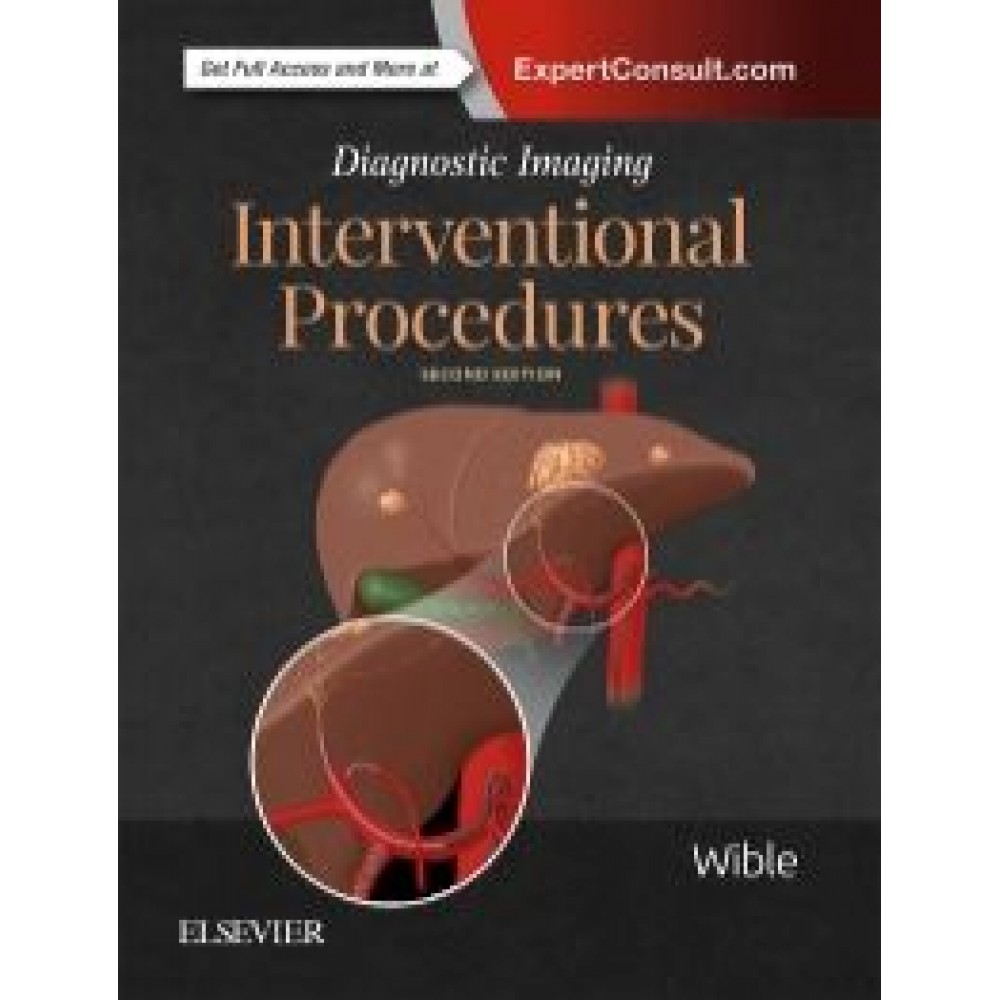 Diagnostic Imaging: Interventional Procedures, 2nd Edition - Wible