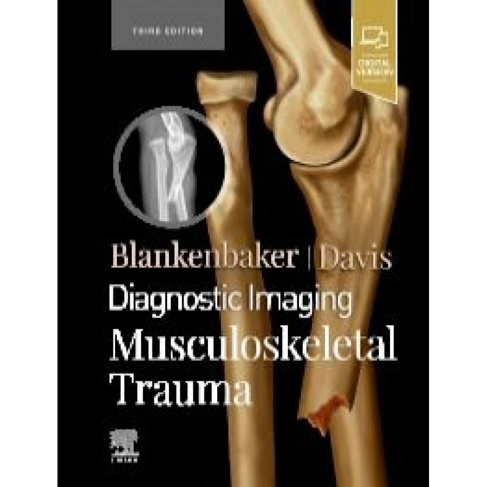 Diagnostic Imaging: Musculoskeletal Trauma, 3rd Edition Blankenbaker
