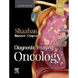 Diagnostic Imaging: Oncology, 2nd Edition - Shaaban
