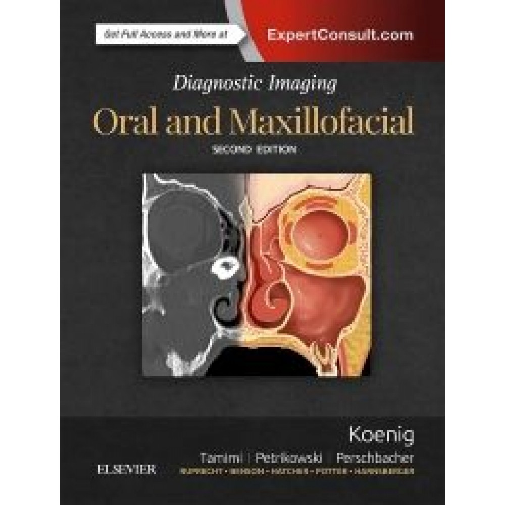 Diagnostic Imaging: Oral and Maxillofacial, 2nd Edition - Koenig
