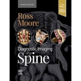 Diagnostic Imaging: Spine, 4th Edition - Ross
