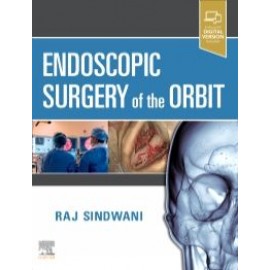 Endoscopic Surgery of the Orbit, 1st Edition