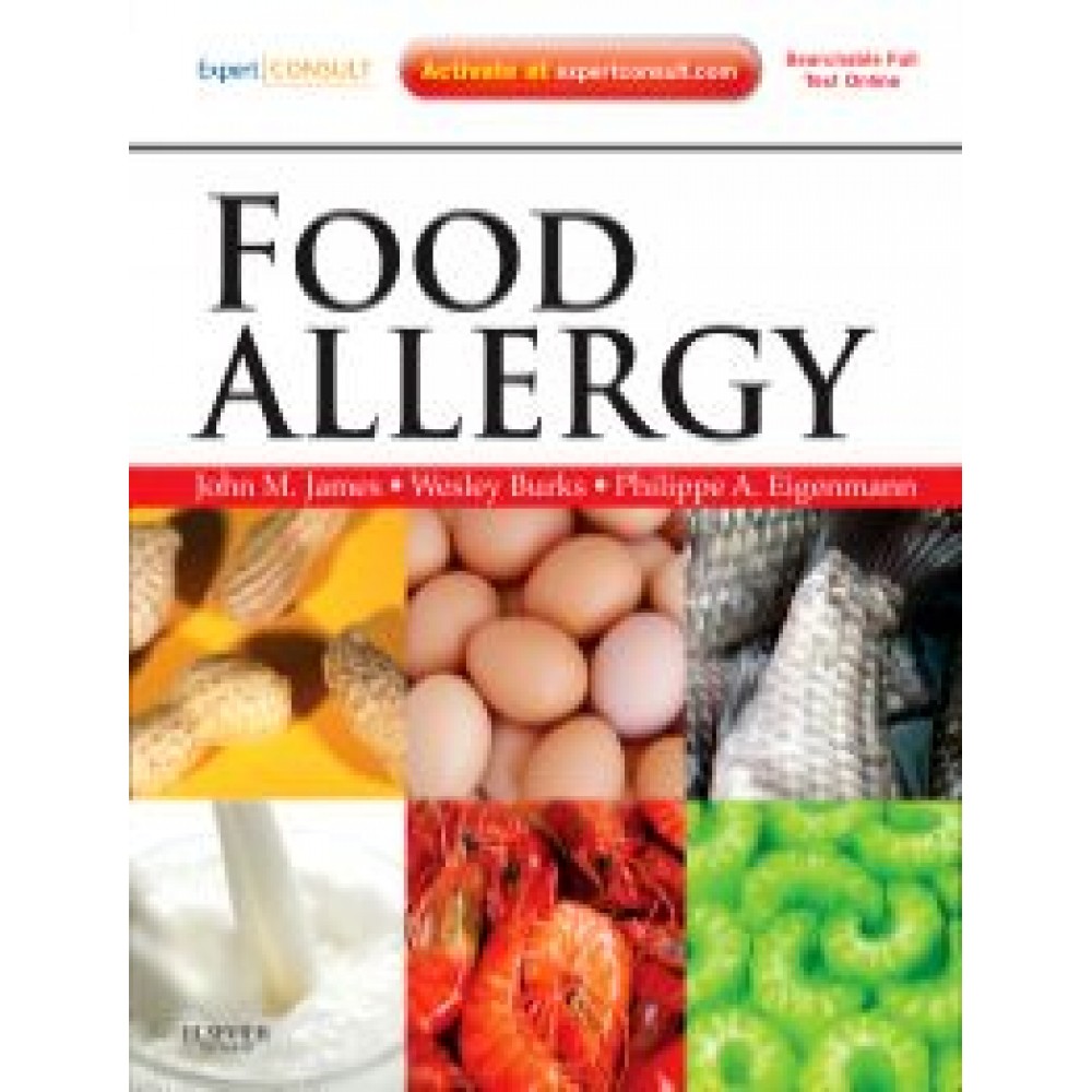 Food Allergy - Wesley