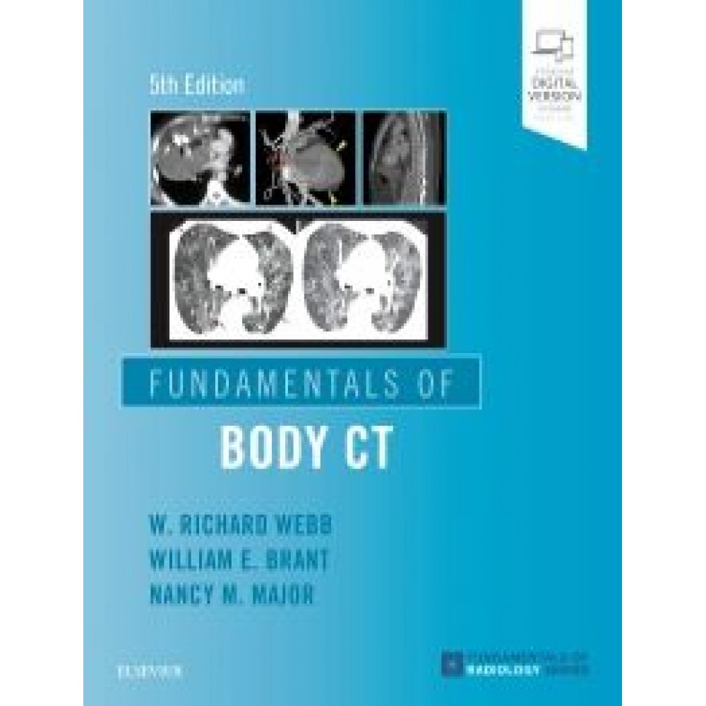 Fundamentals of Body CT, 5th Edition -Webb