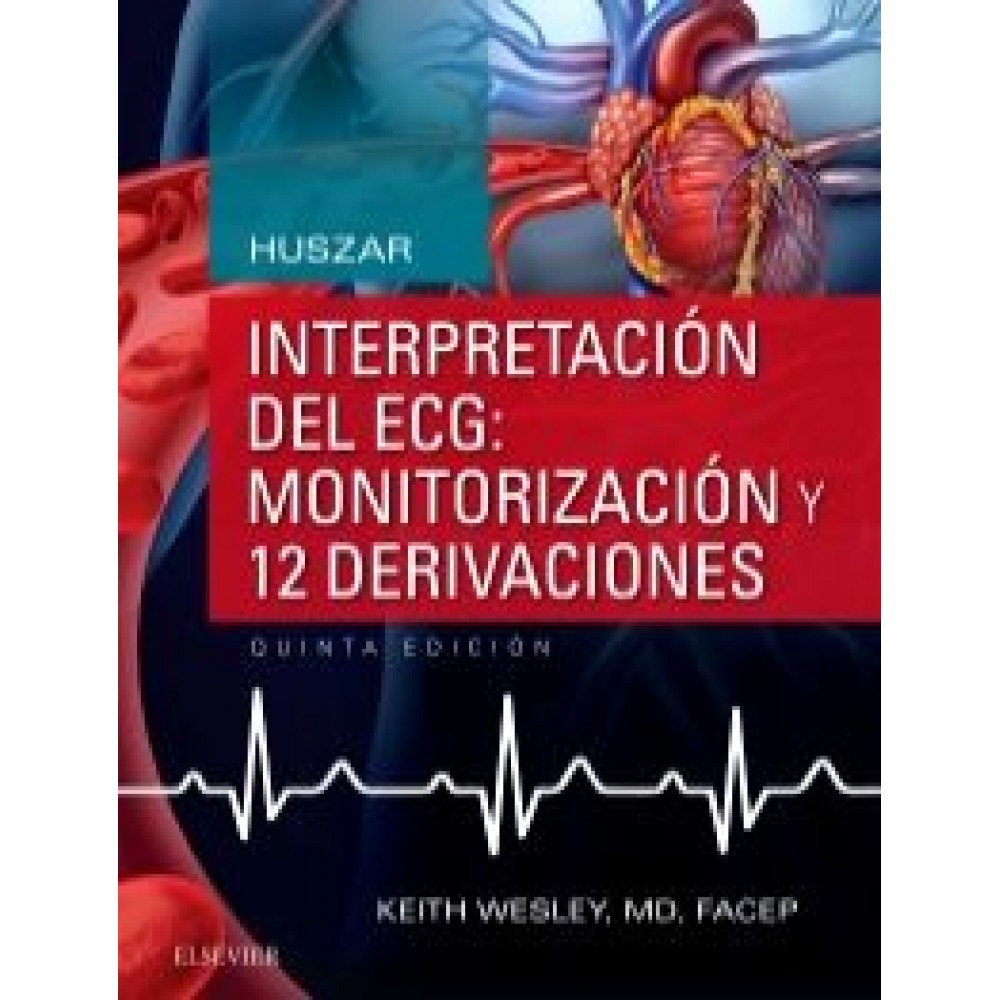 Interpretacion del ECG: monitorizacion y 12 derivaciones - Huszar