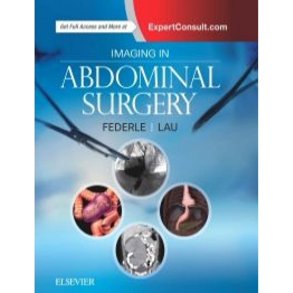 Imaging in Abdominal Surgery - Federle