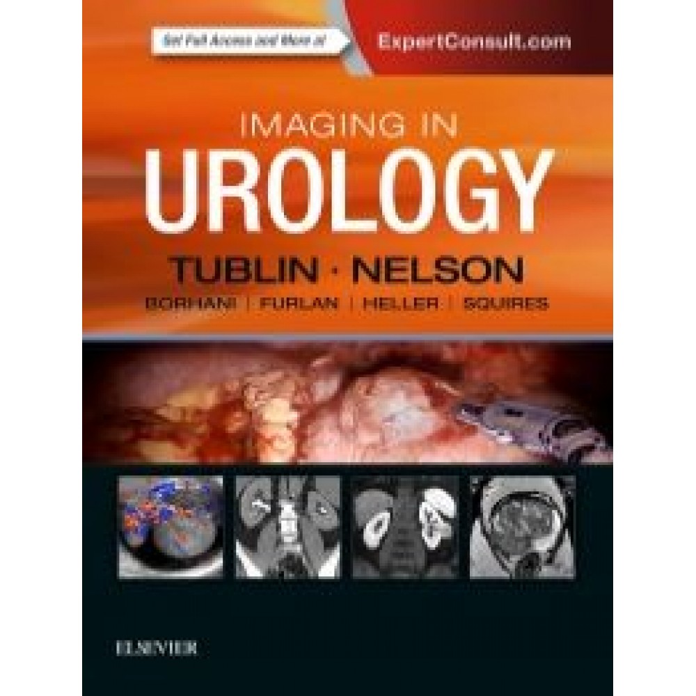 Imaging in Urology, Tublin