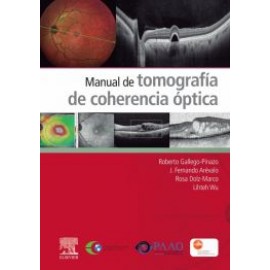 Manual de tomografia de coherencia optica