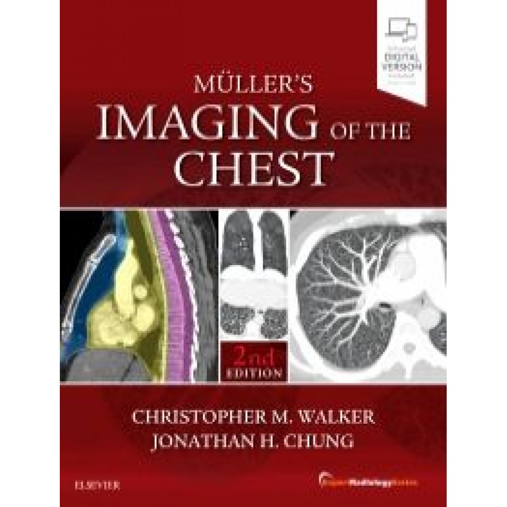 Muller's Imaging of the Chest, 2nd Edition