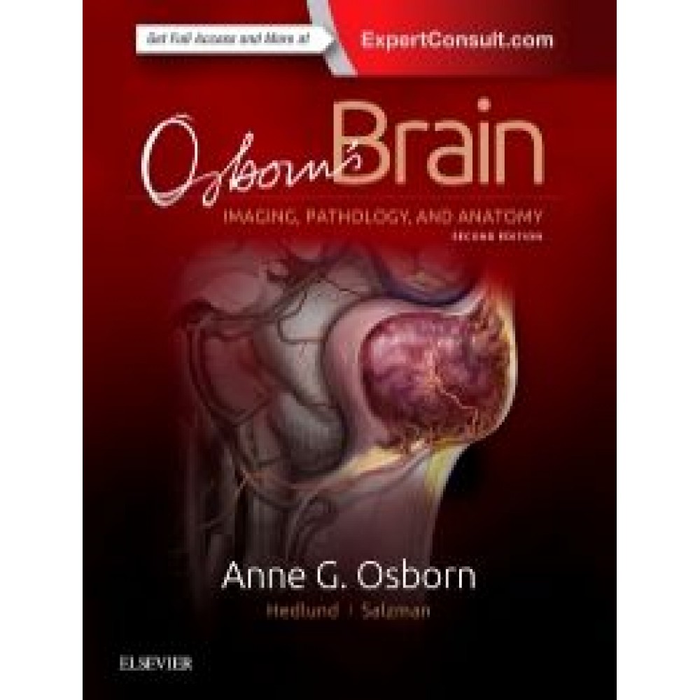 Osborn's Brain, 2nd Edition - Osborn