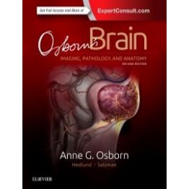 Osborn's Brain, 2nd Edition - Osborn