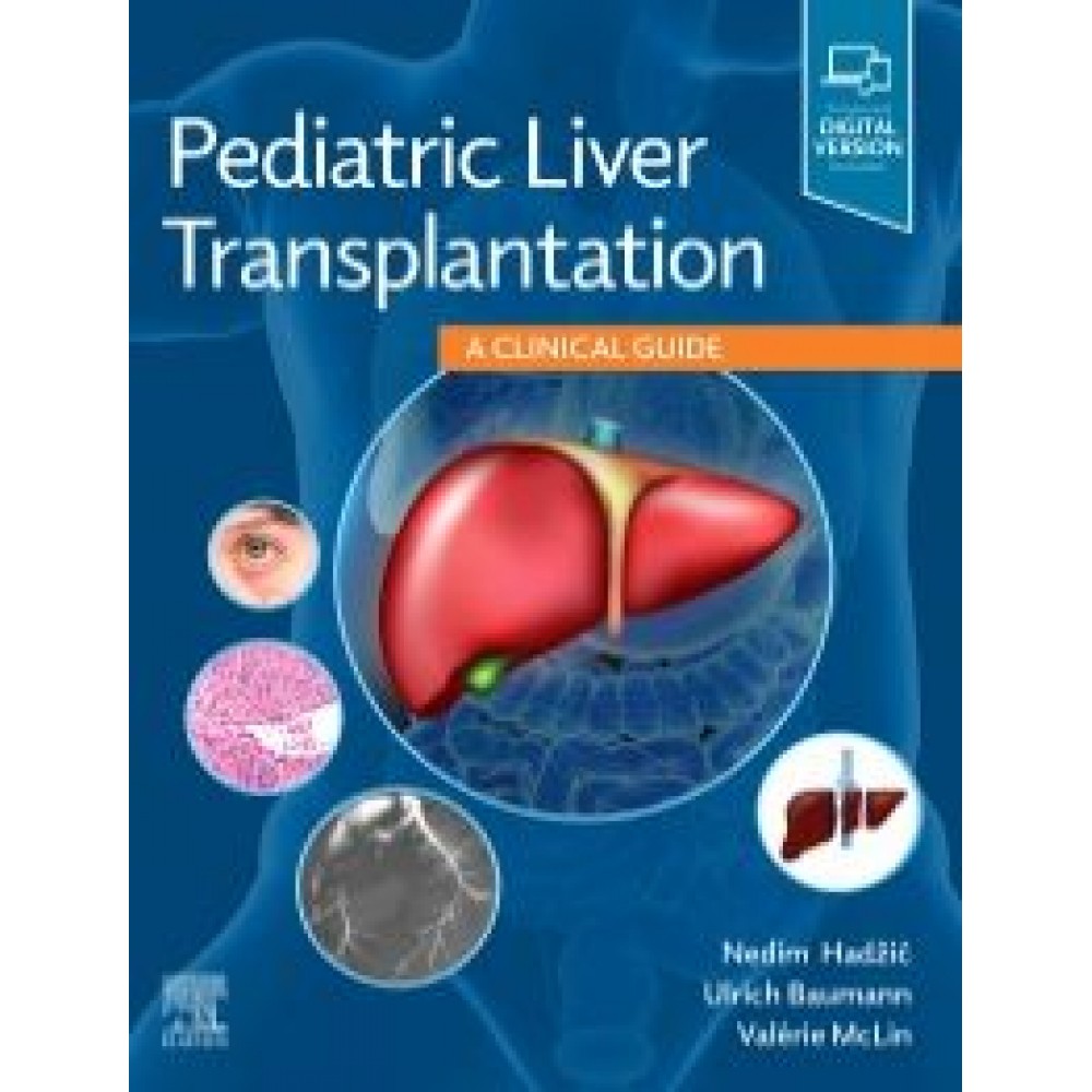 Pediatric Liver Transplantation -Hadzic