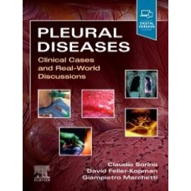 Pleural Diseases Clinical Cases and Real-World Discussions Sorino