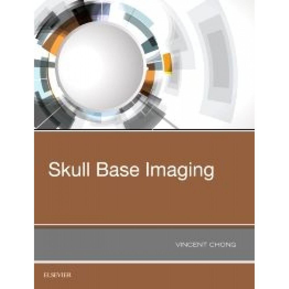 Skull Base Imaging - Chong