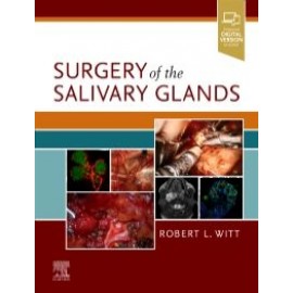 Surgery of the Salivary Glands