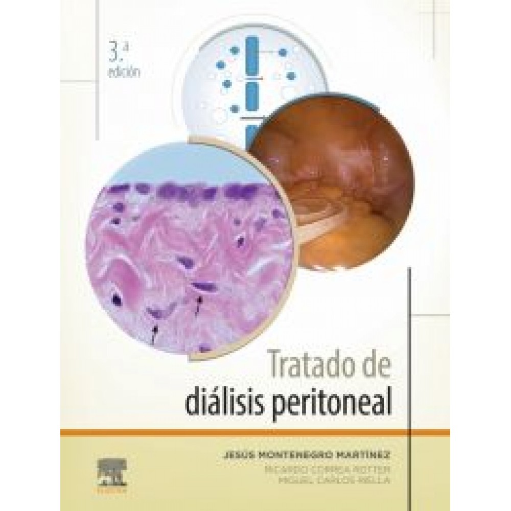 Tratado de diálisis peritoneal 3ª ed. - Montenegro