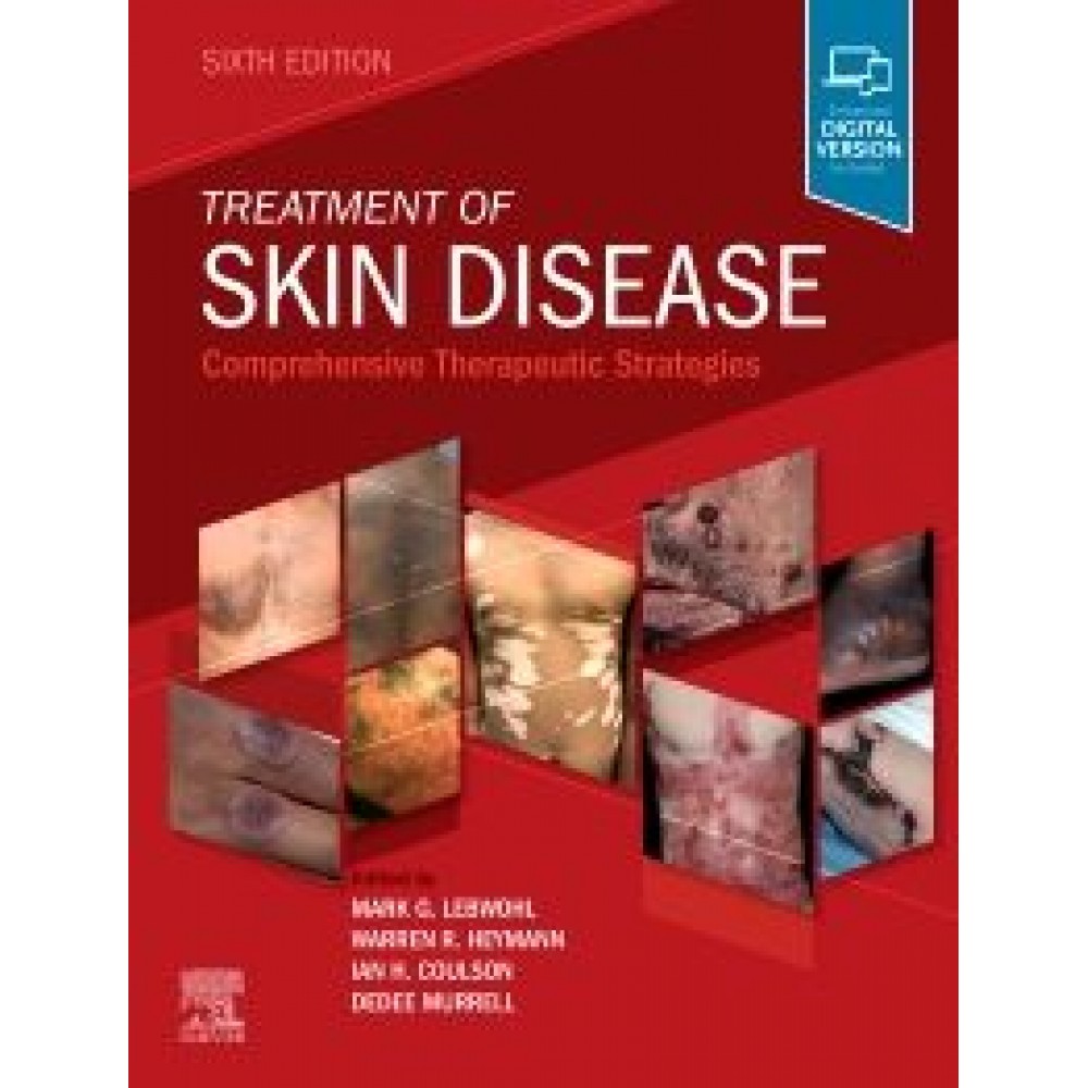 Treatment of Skin Disease, 6th Edition Lebwohl
