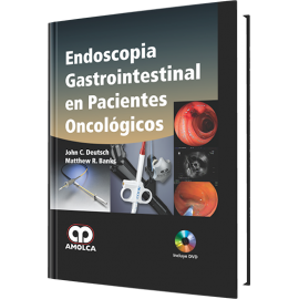 Deutsch, Endoscopia Gastrointestinal en Pacientes Oncologicos