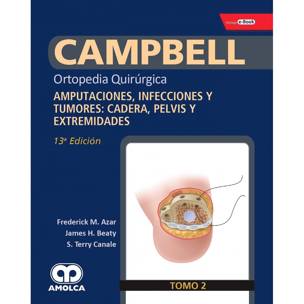 Campbell Ortopedia 13ª ed. Tomo 2 : Amputaciones, infecciones y tumores: Cadera pelvis y Extremidades