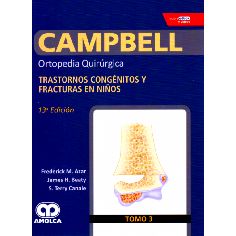 Campbell Ortopedia 13ª ed.Tomo 3 : Transtornos Congenitos y Fracturas en Niños