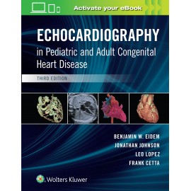Echocardiography in Pediatric and Adult Congenital Heart Disease Third Ed. - Eidem