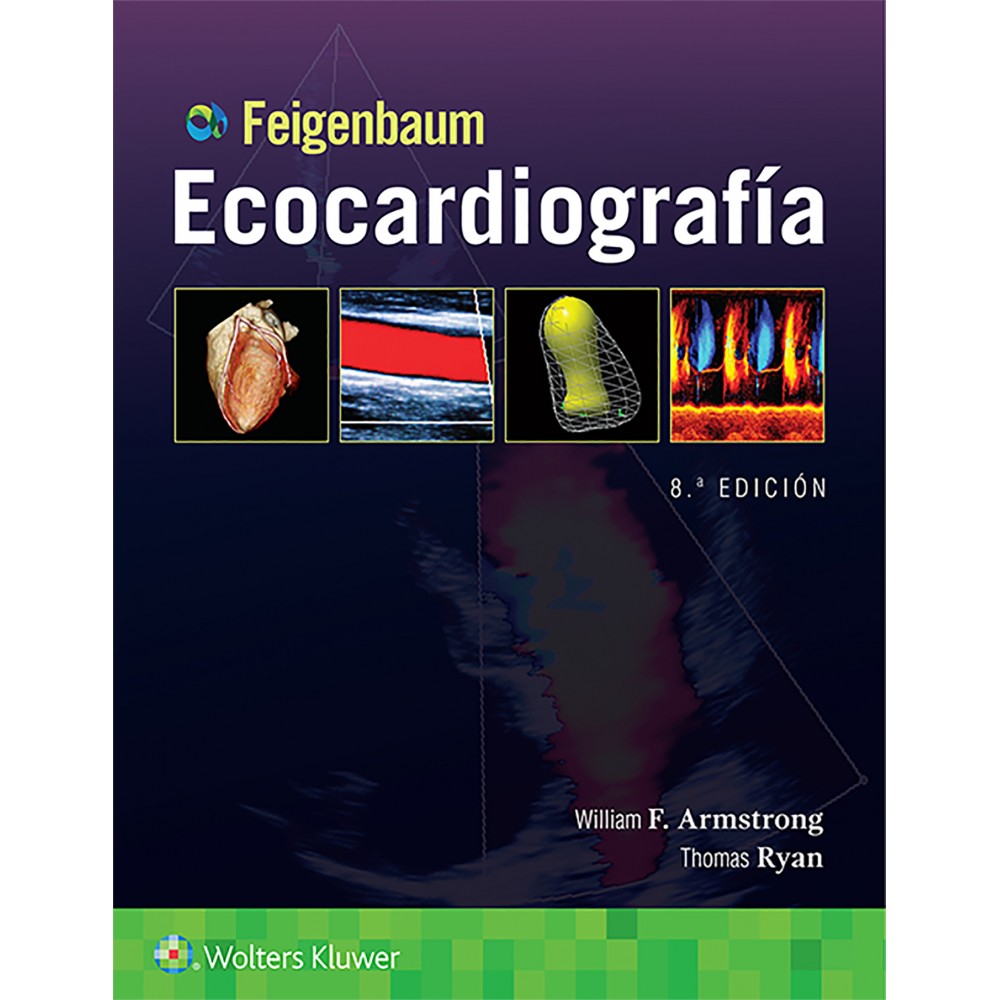 Feigenbaum. Ecocardiografia
