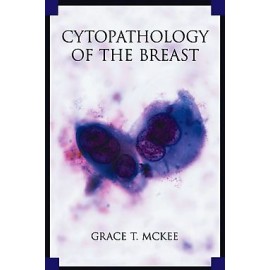 McKee, Cytopathology of the Breast