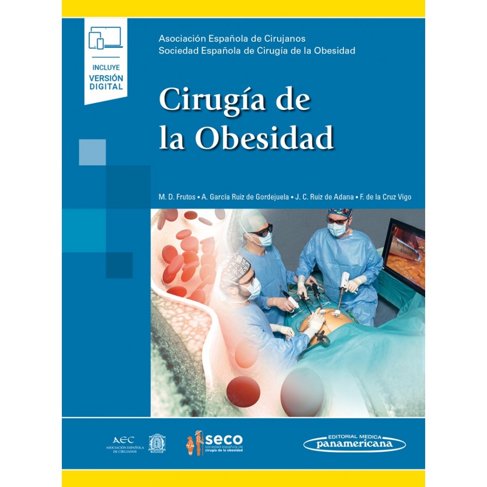 Cirugia de la Obesidad - SECO Libro + ebook