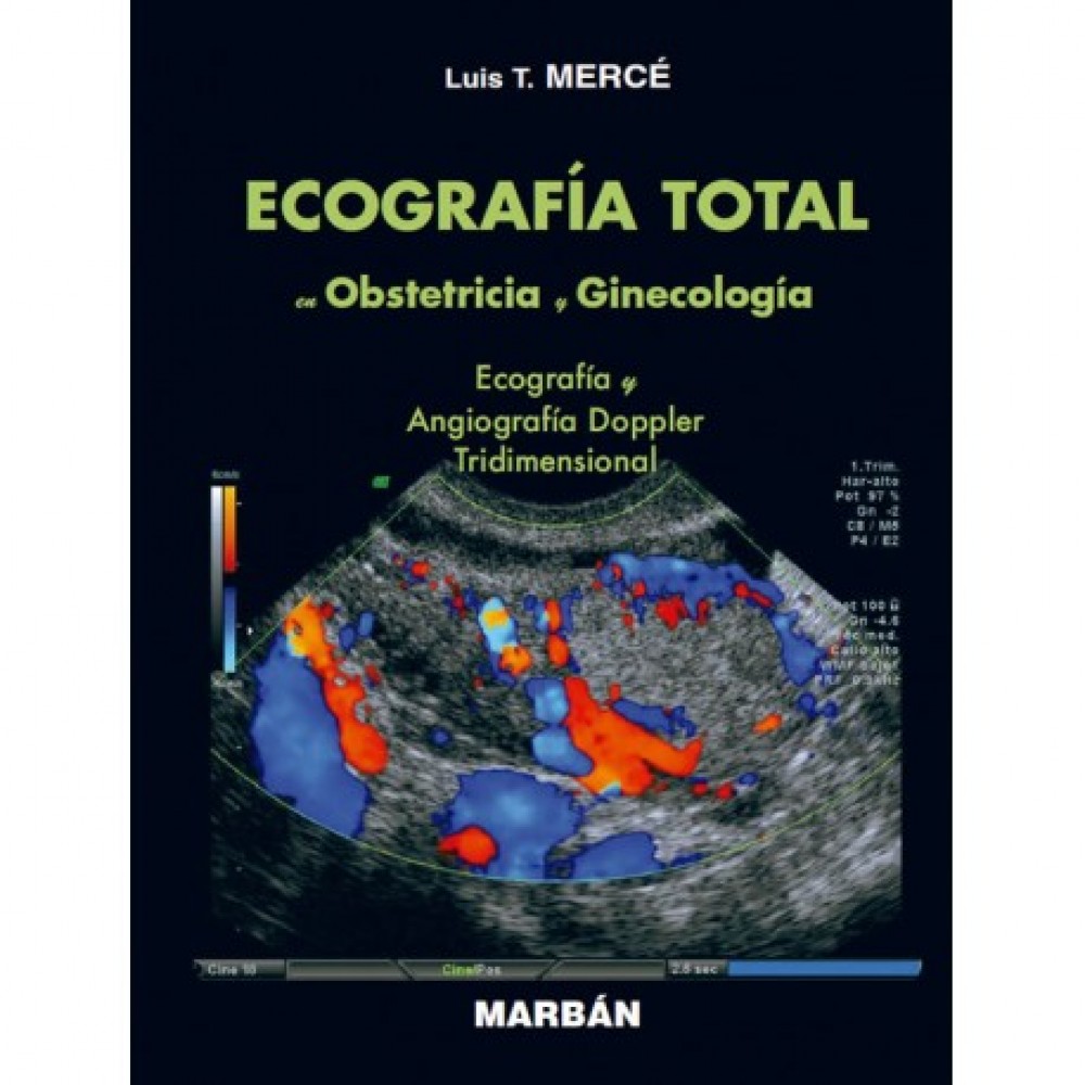 Merce, Ecografia Total en Obstetricia y Ginecologia. Ecografia y Angiografia Doppler Tridimensional. Tapa Blanda
