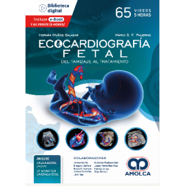 Muñoz, H. Ecocardiografia Fetal del Tamizaje al Tratamiento