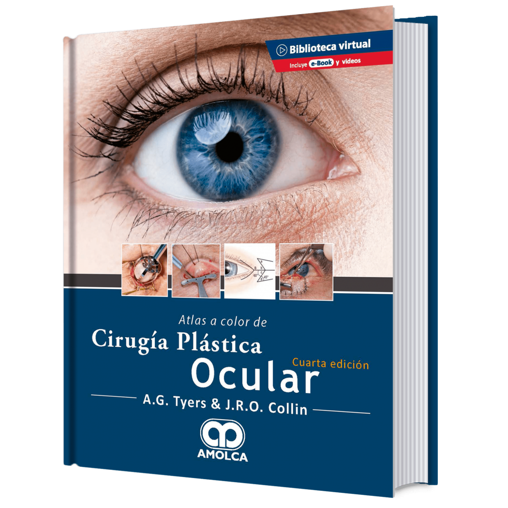 Tyers  Atlas a color de cirugia plastica ocular 4ª ed.