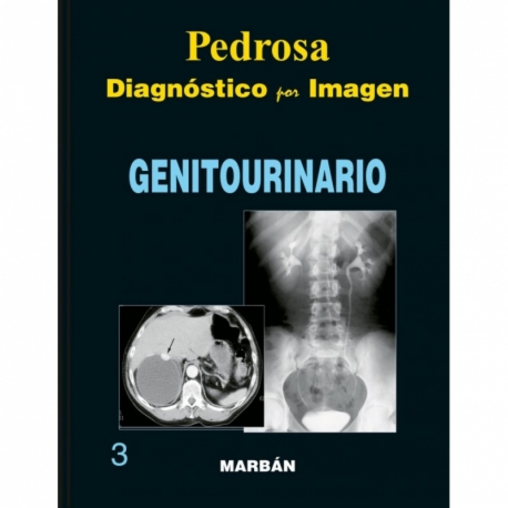 Pedrosa, Diagnostico por imagenes Genitourinario Tapa Blanda